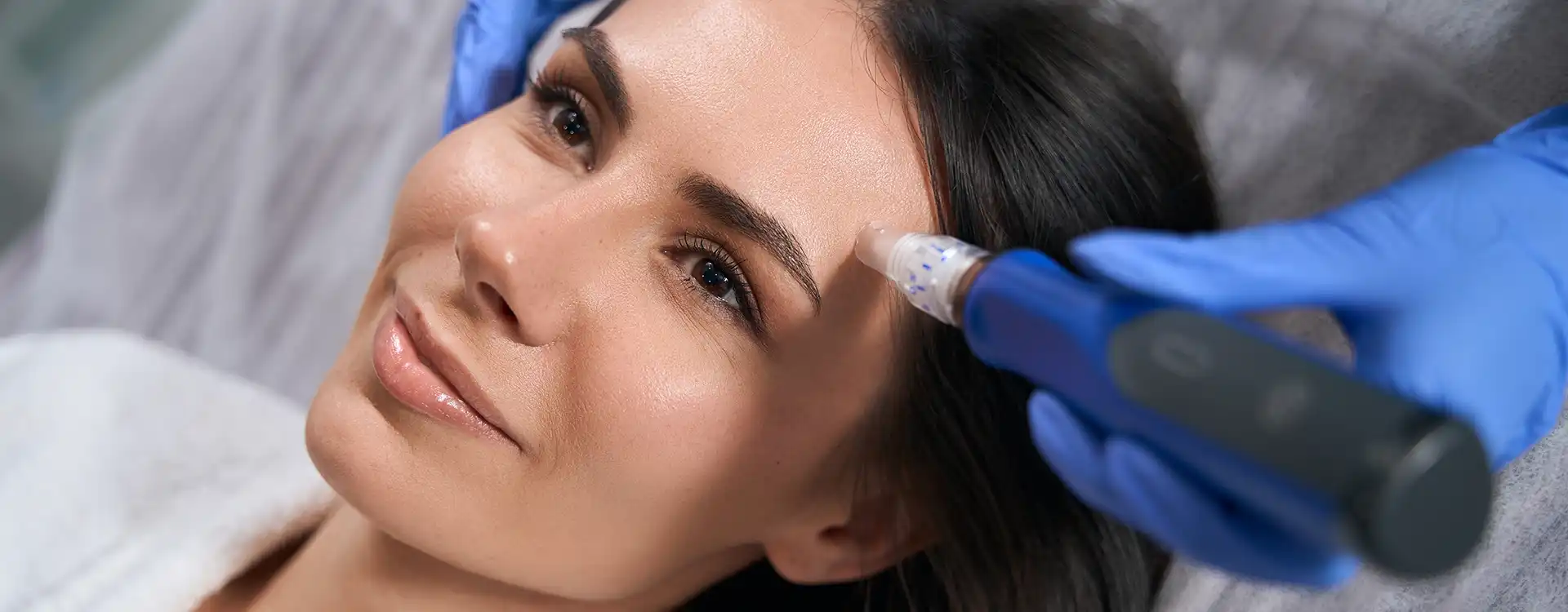 Microneedling | Northeast Medical Aesthetics Microneedling | Northeast Medical Aesthetics