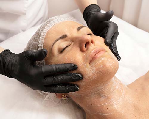 Chemical Peel  Frequently Asked Questions | Northeast Medical Aesthetics