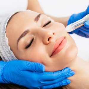 Microneedling | Northeast Medical Aesthetics