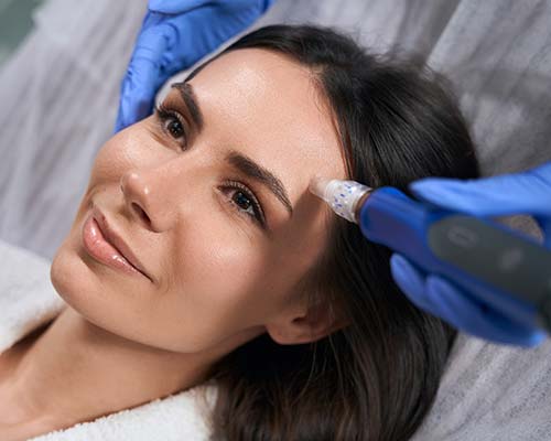 Microneedling | Northeast Medical Aesthetics