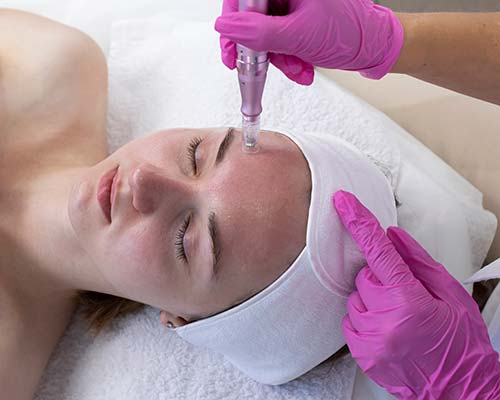Microneedling | Northeast Medical Aesthetics