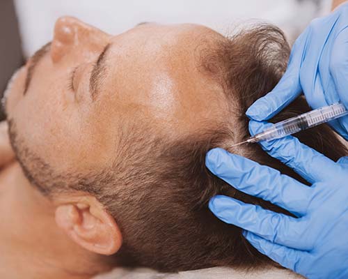 Man Hair Condition & Treatment | Northeast Medical Aesthetics | Ant-Aging