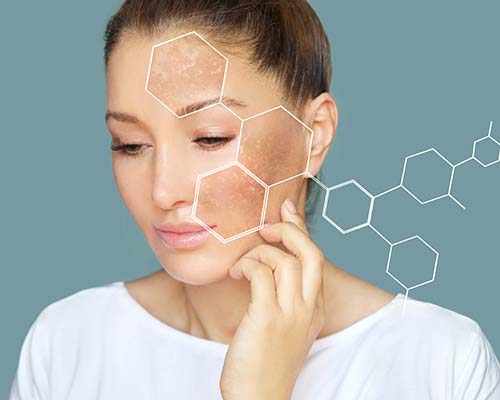 Woman Patchy Skin Condition | Northeast Medical Aesthetics | Beauty & Ant-Aging Services
